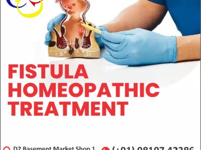 Comprehensive Guide to Fistula Homeopathic Treatment (Delhi)