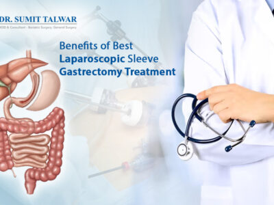 Best Laparoscopic Sleeve Gastrectomy Treatment in Bangalore