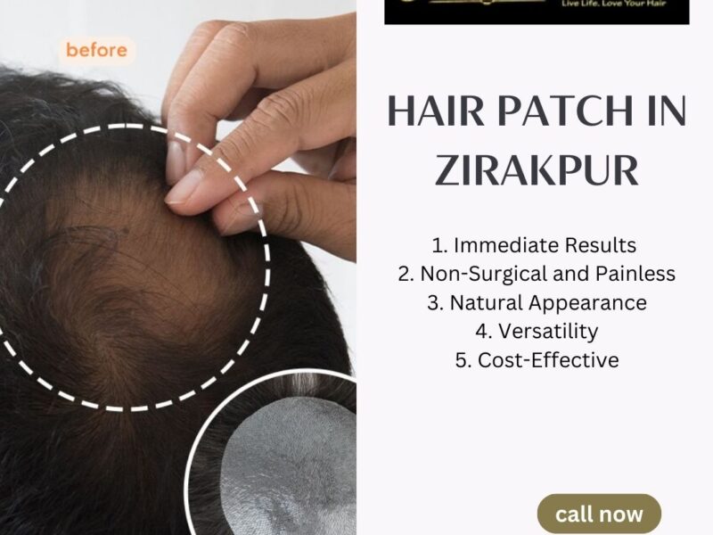 Best Hair Patch In Zirakpur- Kalakaar Hair Studio