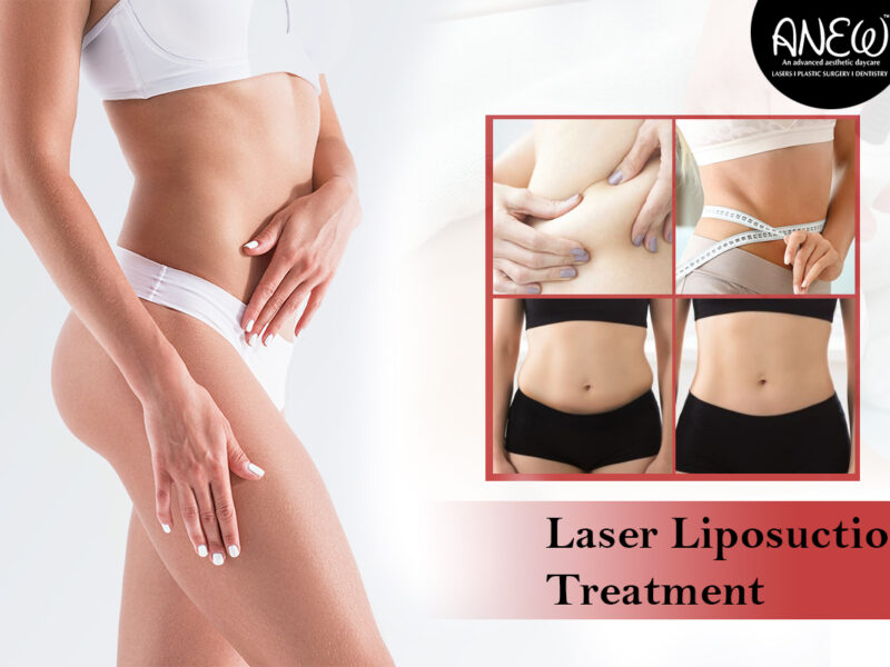 Improve Your Body with Laser Liposuction at Anew Cosmetic Clinic