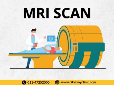 MRI Scan Near Me In Delhi At Affordable Price | MRI Cost In Delhi