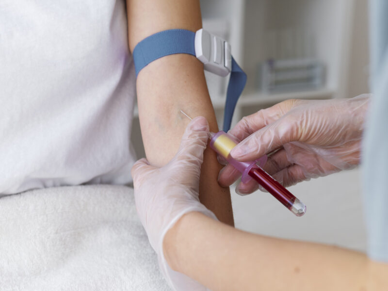 How to Prepare for a Blood Test Houston