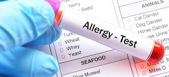 Allergy Test in Delhi - Book Your Appointment Now!