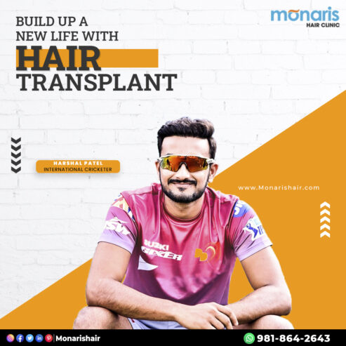 Discover the Best Hair Transplant in Delhi