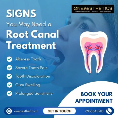 Painless Root Canal Treatment in Gurgaon