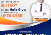 Discover the Best Hair Transplant in Delhi