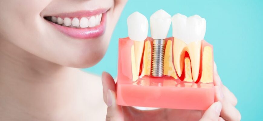 Best Dental Clinic in Nagpur