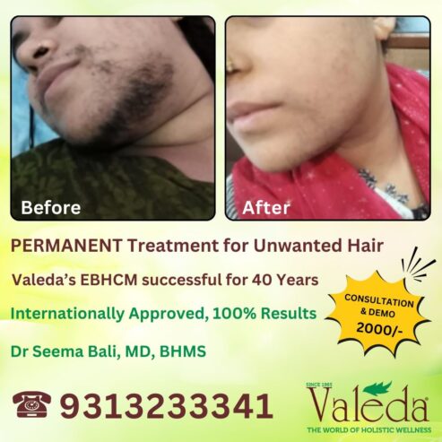 title- PERMANENT TREATMENT FOR UNWANTED HAIR VALEDA EB