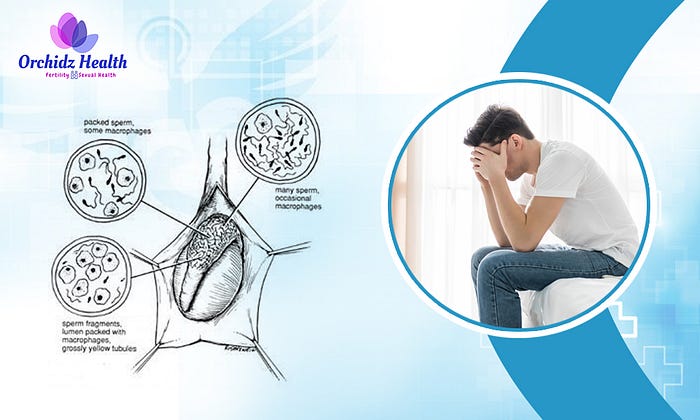 Best Azoospermia Treatment in Bangalore – Orchidz Heal