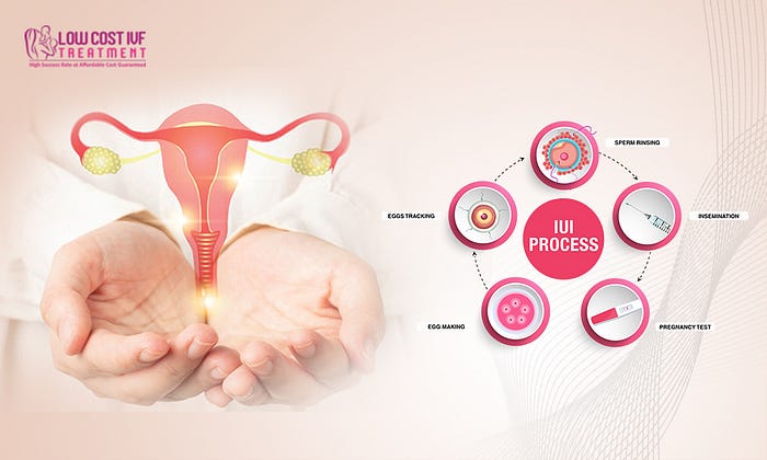 Effective IUI Treatment in Bangalore – Low Cost IVF Tr