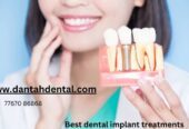 Dantah Dental The Best Dental Clinic in Gangapur Road,