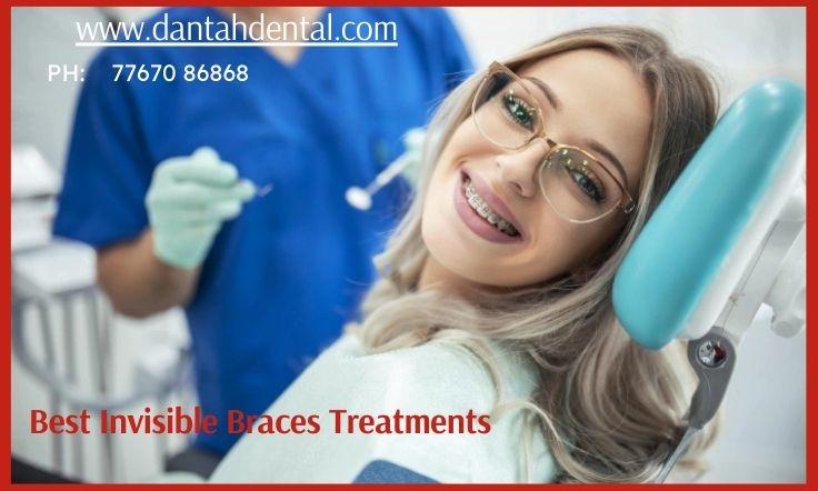 Dantah Dental The Best Dental Clinic in Gangapur Road,