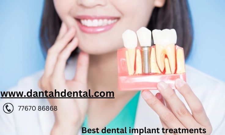 Dantah Dental The Best Dental Clinic in Gangapur Road,