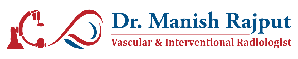 Dr Manish Rajput Varicose Veins