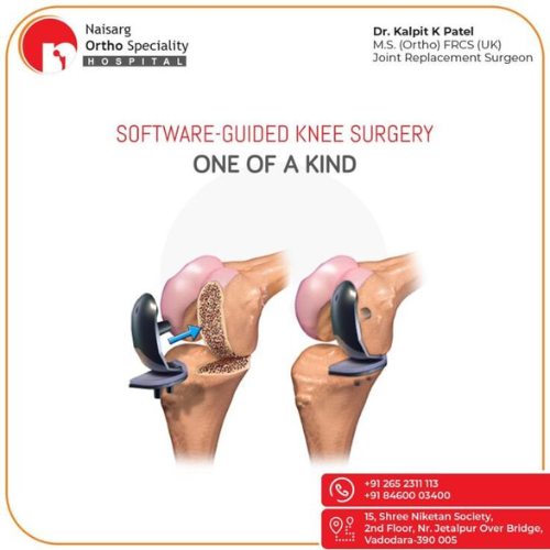 Microplasty Knee Surgery