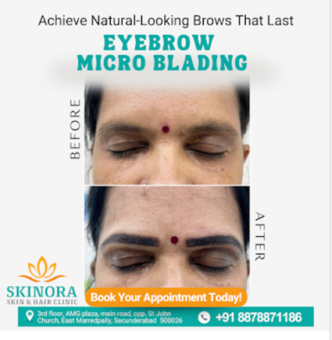 Skinora Skin & Hair Clinic