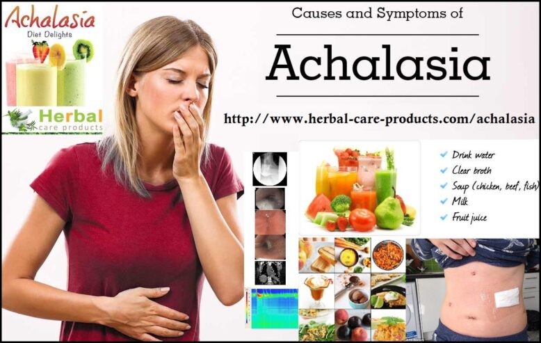 Achnical: Achalasia Herbal Supplement