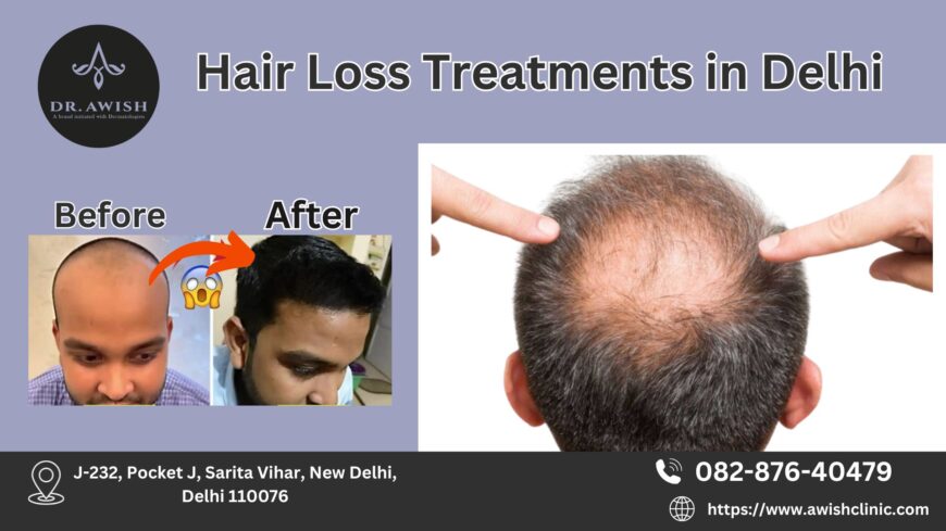 best hair loss treatment