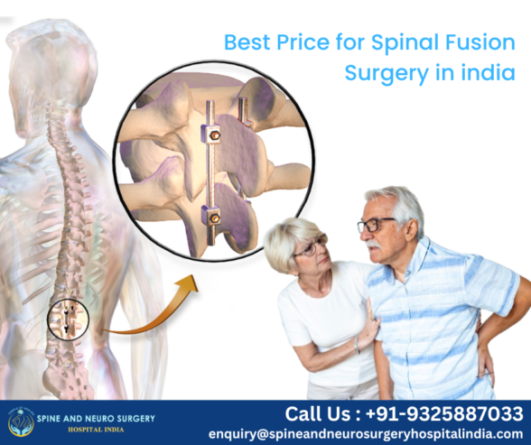 Top hospitals for Spinal Fusion india