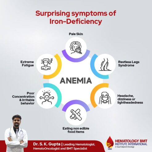 Best Aplastic Anemia Treatment: