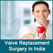 dp-valve-replacement-surgery-in-india