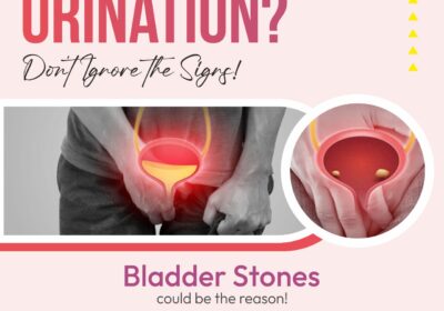 bladder-stone