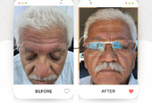 Top Skin & Homeopathy Clinic in Balewadi – Dr. Anuradh