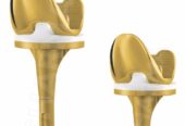 Buy High-Quality Total Knee Replacement Implants from