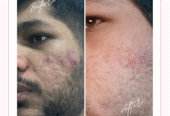 Top Skin & Homeopathy Clinic in Balewadi – Dr. Anuradh