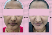 Top Skin & Homeopathy Clinic in Balewadi – Dr. Anuradh