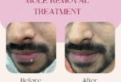 Top Skin & Homeopathy Clinic in Balewadi – Dr. Anuradh