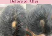 Top Skin & Homeopathy Clinic in Balewadi – Dr. Anuradh
