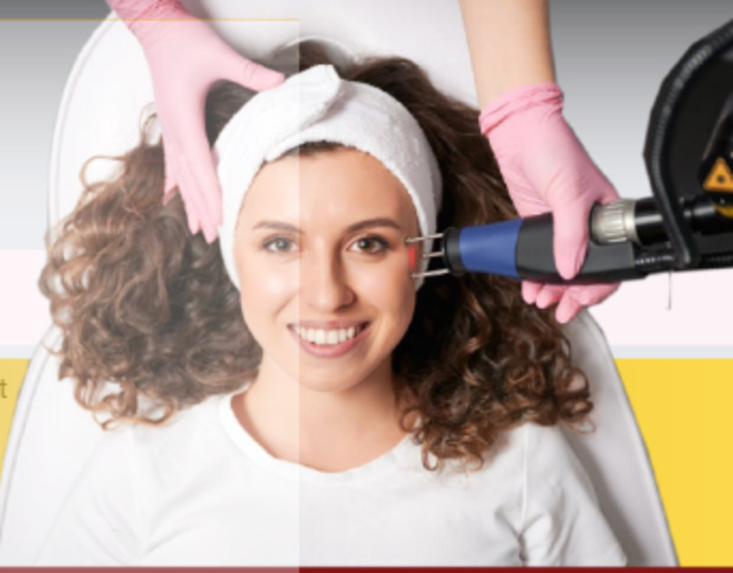 Revitalize Your Skin with CO2 Laser Treatment in Delhi