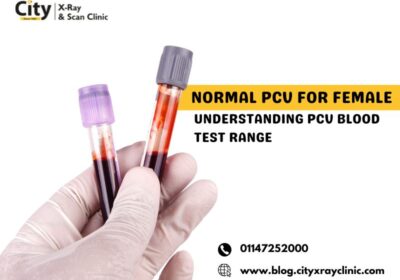 Normal-PCV-for-Female-–-Understanding-PCV-Blood-Test-Range