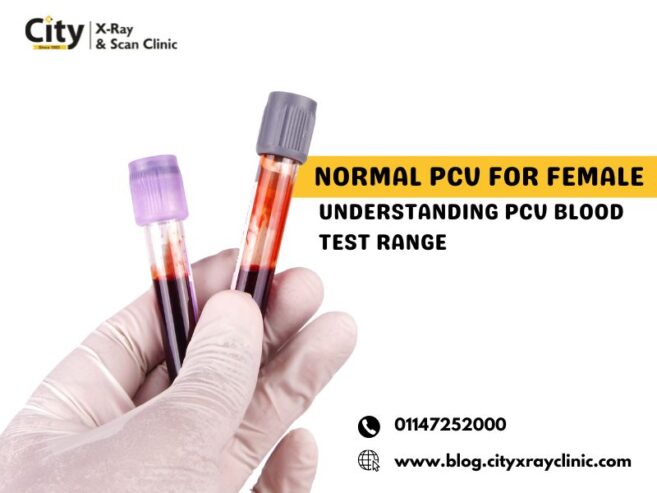 Normal PCV for Female – Understanding PCV Blood Test R