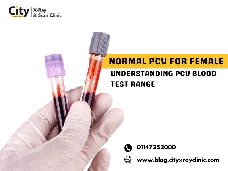 Normal PCV for Female – Understanding PCV Blood Test R