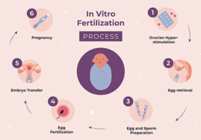 ivf-treatment-procedure-Dr-Rhythm-gupta-640×390-1