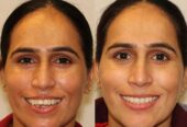 Dr. Ankur Mohindru | Best dentist in amritsar