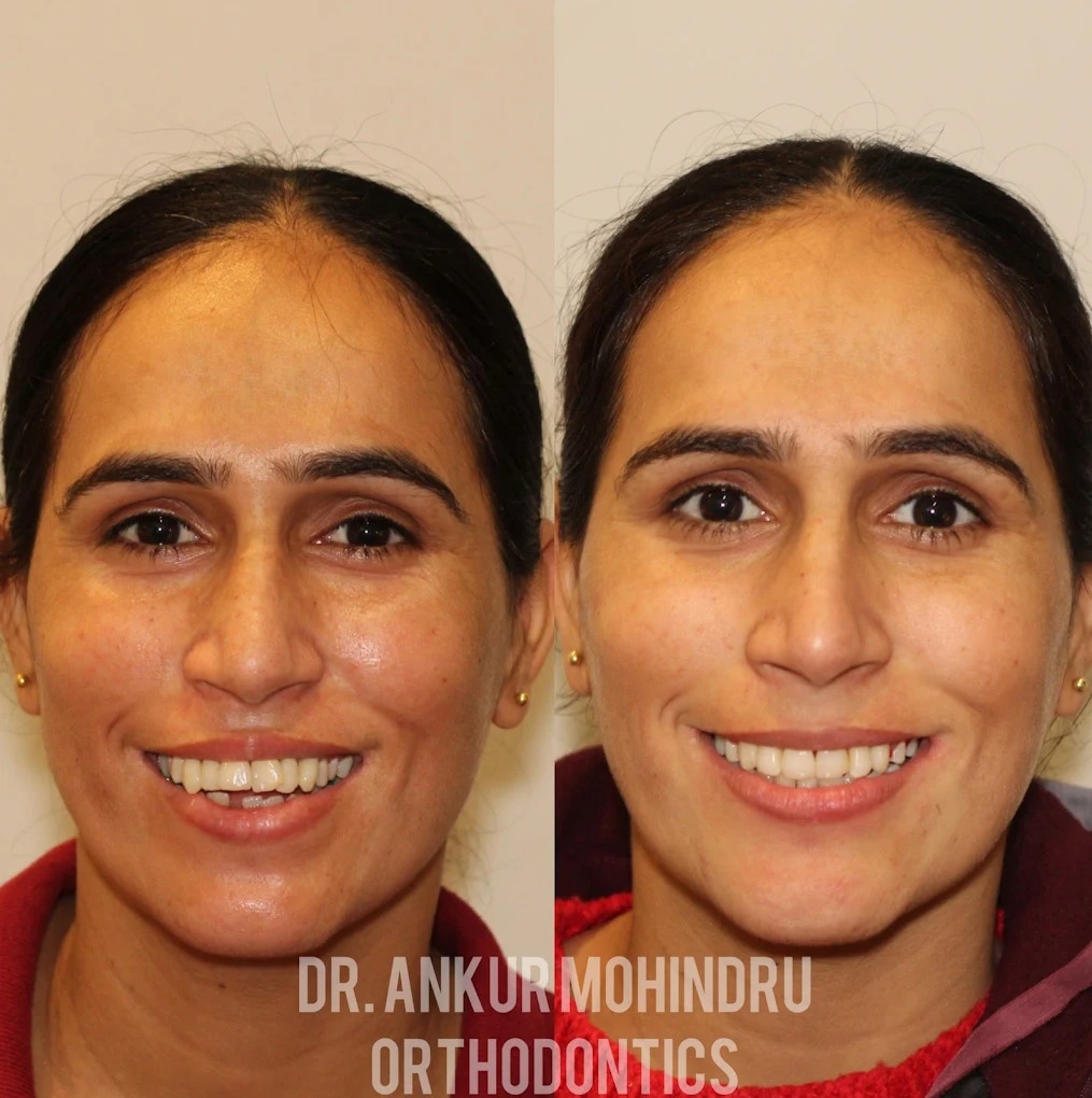 Dr. Ankur Mohindru | Best dentist in amritsar