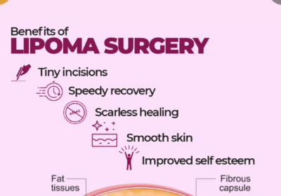 Lipoma-Blog-Photo