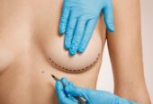 Breast Reduction Surgery in Riyadh