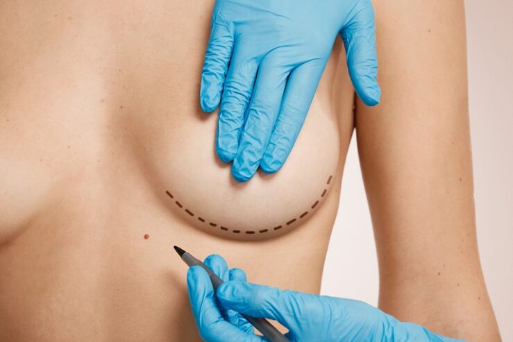 Breast Reduction Surgery in Riyadh