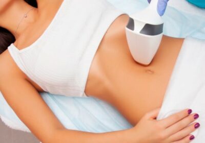 Laser-Liposuction-in-Riyadh-5