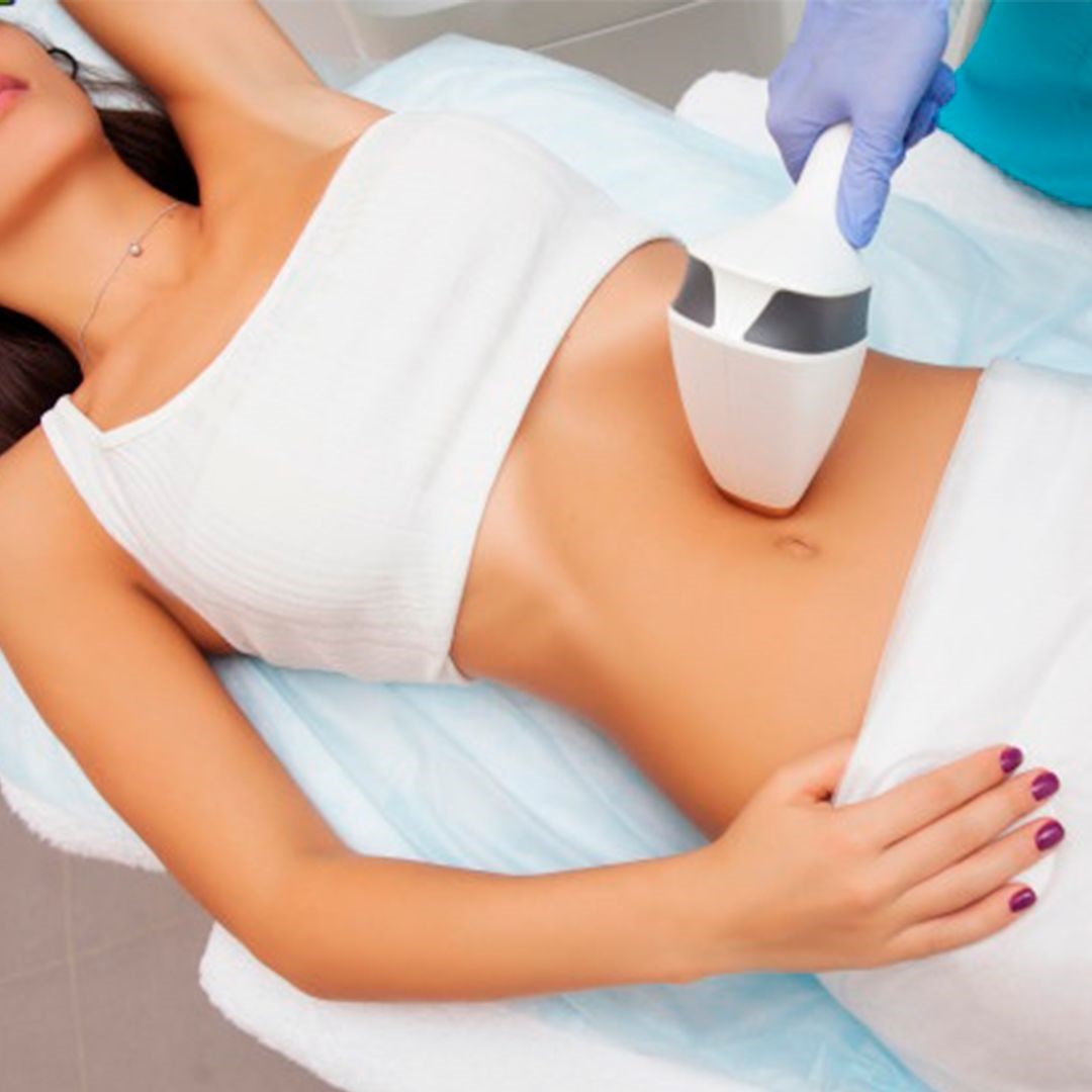 Laser Liposuction in Riyadh