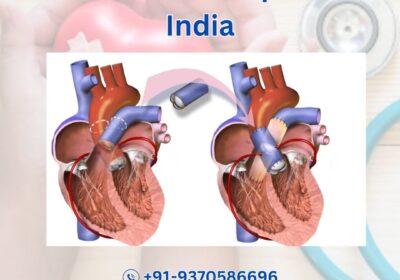Mitral-Valve-Repair-in-India