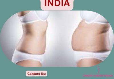 Mommy-Makeover-In-India