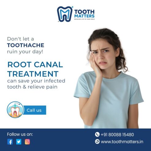 Expert Root Canal Treatment at Tooth Matters