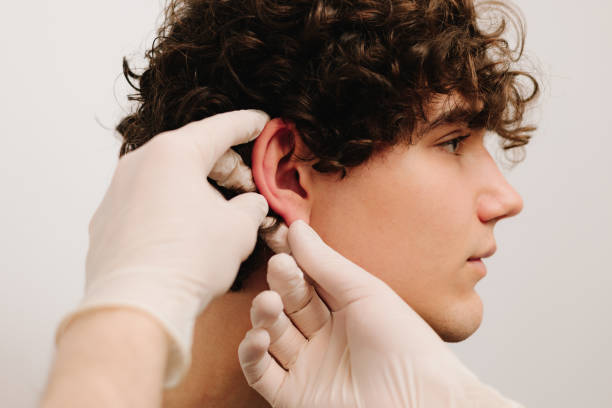 Ear Reshaping Surgery in Riyadh