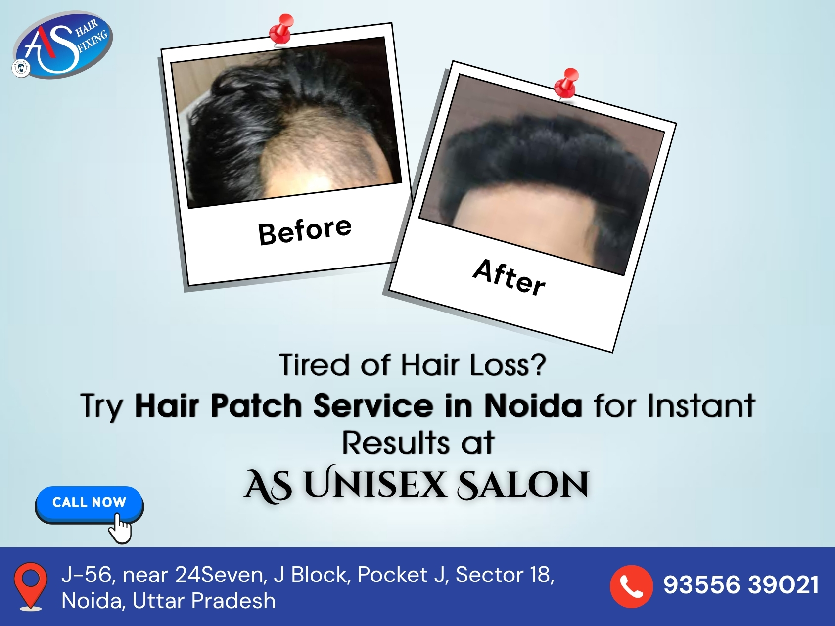 Noida Hair Patch Experts – Real Results That Last