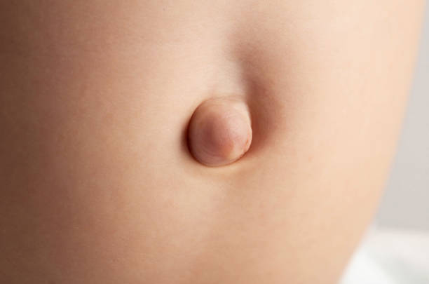 Cost of hernia surgery in Riyadh